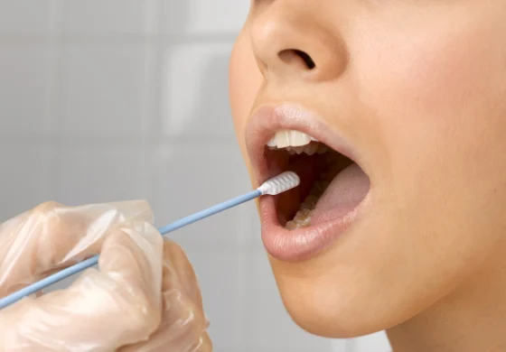 urine drug test collection